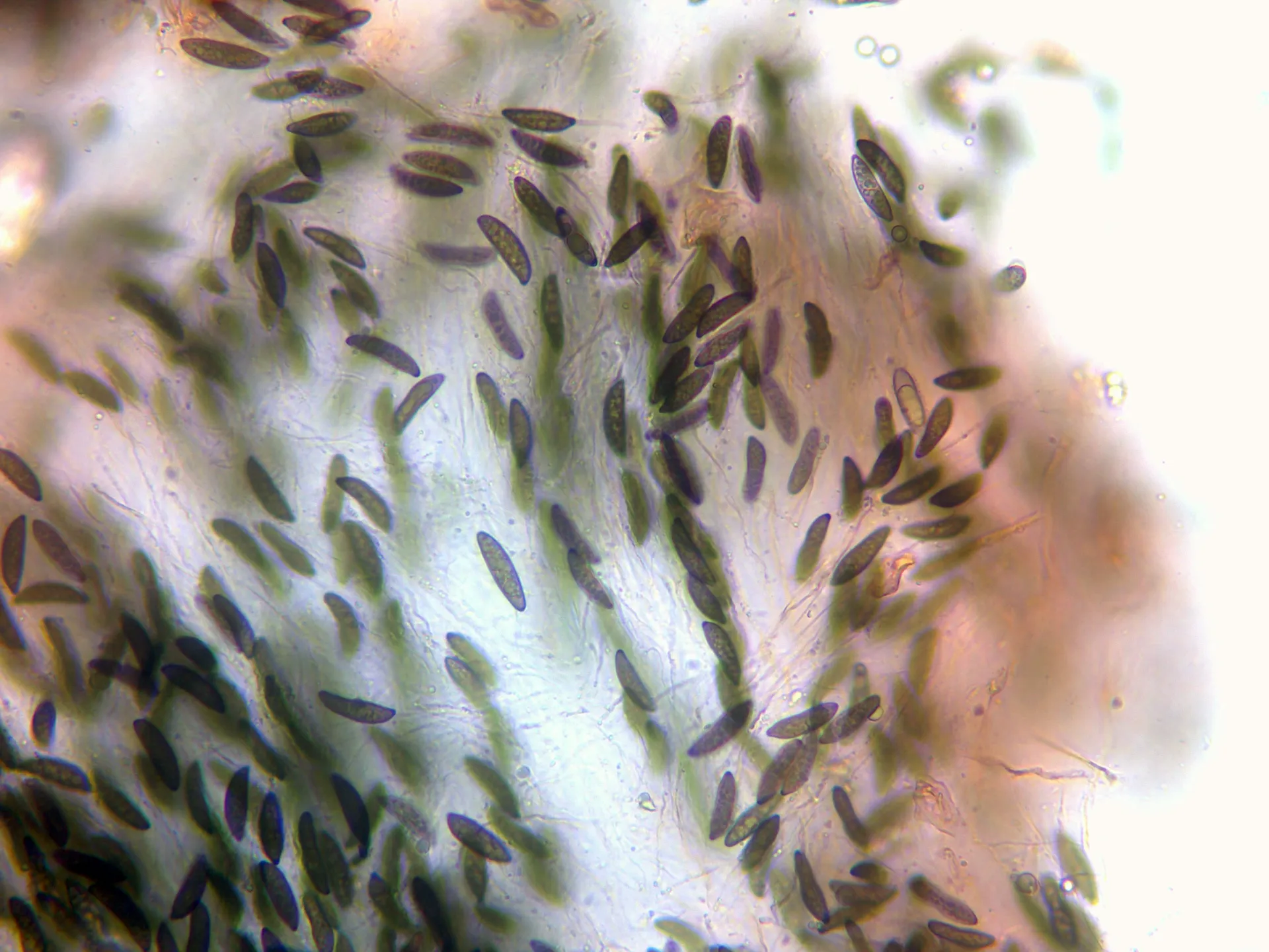 Microscopía de Rosellinia mammiformis - 12 - Himenio x 400-001